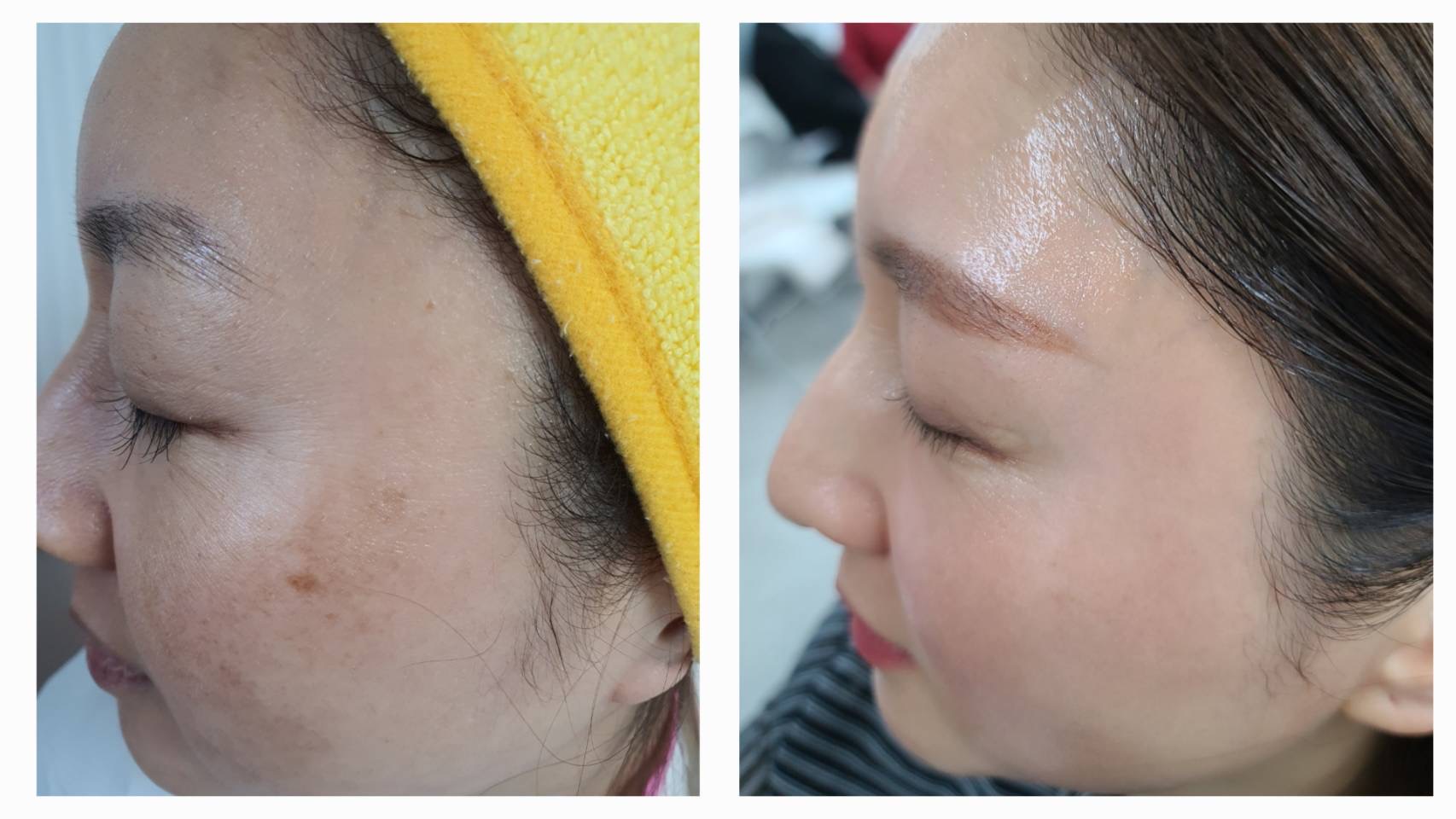 ビフォーアフター 1