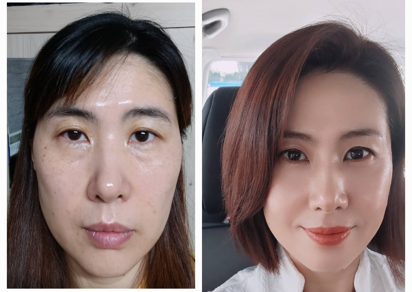 ビフォーアフター 2