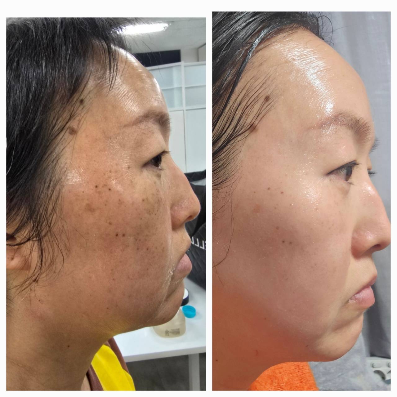 ビフォーアフター 3